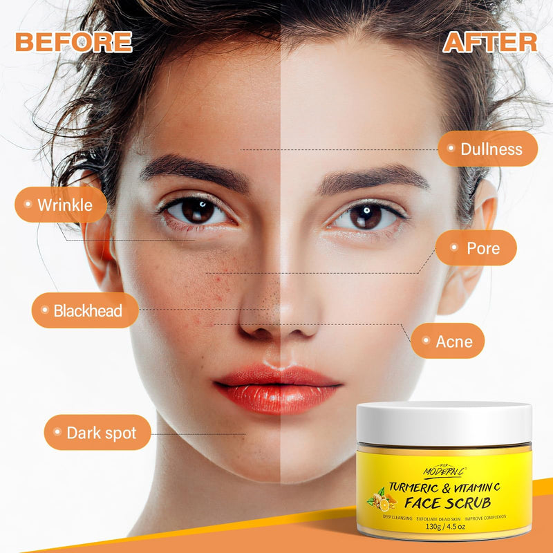 Vitamin C and Turmeric Face Scrub Cream Organics Microdermabrasion Facial Scrub Exfoliating Clears Blackheads Improve Dark Spot Acne with Strawberry Extract Exfoliator 130g/4.5oz 4.5 Ounce (Pack of 1)