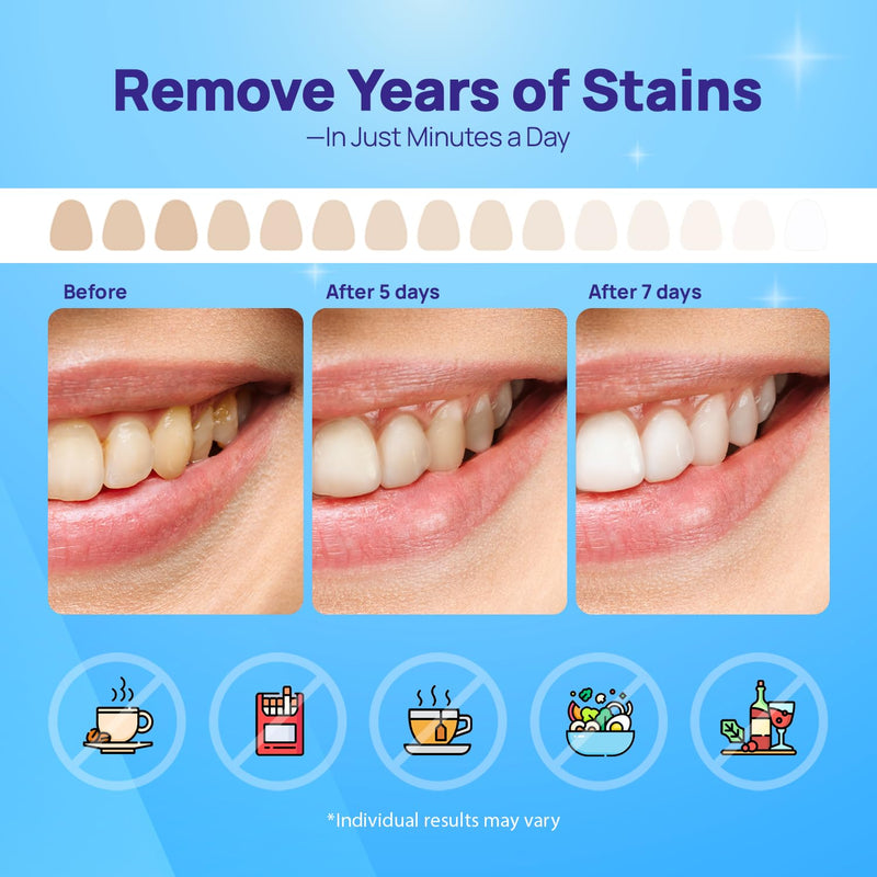 [Australia] - Whitebite Pro Upgraded Teeth Whitening Strips 28 Strips (14 Treatments) | Enamel-Safe | Deep Stains Removal | Non-Slip Design | Whitening Without Any Harm | Mint 28 Count (Pack of 1) 