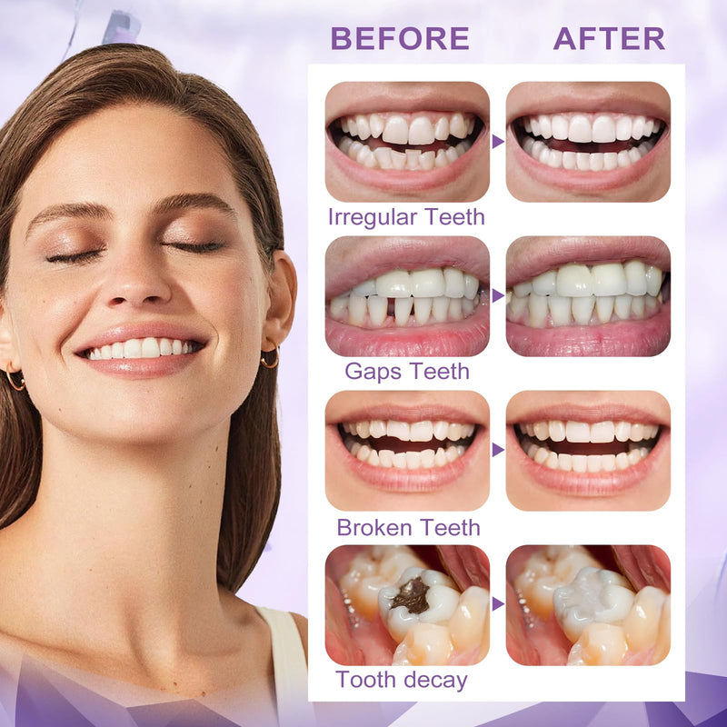 Tooth Repair Kit,Moldable Beads for Teeth Repair,DIY Tooth Filling Repair Kit Fixing The Missing and Broken Replacements, DIY Natural Filling Fake Teeth,Smile Confidently Again(100 Grams)-B01