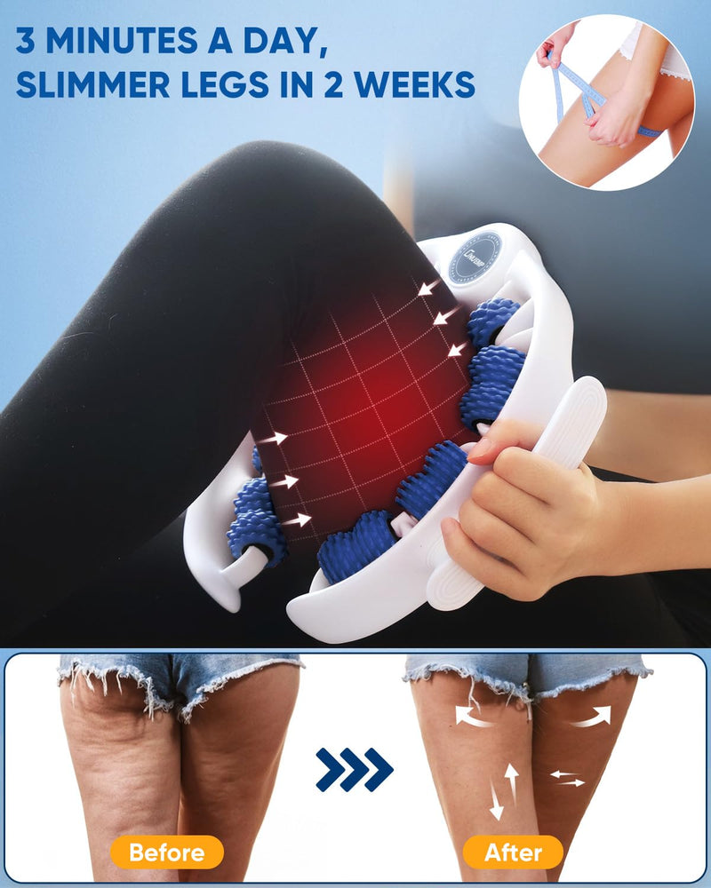 [Australia] - ONUEMP Cellulite Massage Tool, Lymphatic Drainage Cellulite Remover for Legs, Muscle Roller Fascia Massage - Body Sculpting, Lipedema Massagers, Celulitis Reduccion, Deep Tissue Pain Relief, Blue 