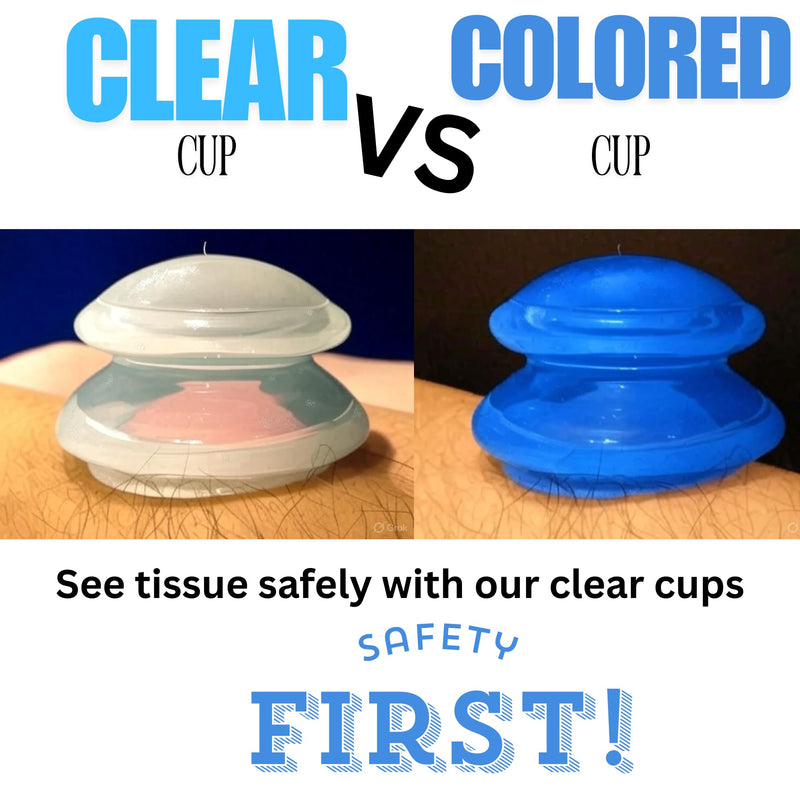 Cupping Warehouse Supreme 4 Intermediate Pro 5560 Beginner Silicone Cupping Set – 4 Cups for Body Sculpting, Massage Therapy, Pain Relief, Cellulite Reduction (S1.3, M1.6, L2.1, XL2.75)