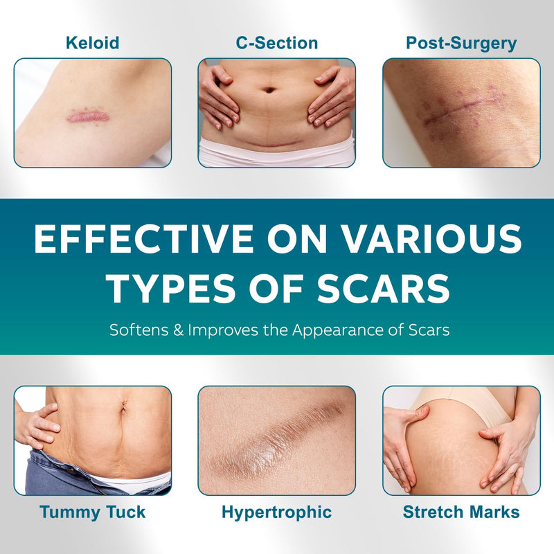 [Australia] - Scar Plaster, Scar Roller, Silicone Plaster for Scars, Scar Care, Silicone Scar Plaster for C-Section, Surgery, Burns, Keloid, Acne [Large, 4cmx300cm] Silicone Plasters for Scars 
