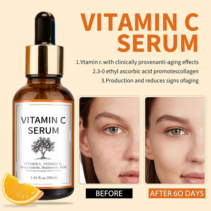 Vitamin C Brightening Serum with Hyaluronic Acid & Vitamin E – Dark & Even Skin Tone for Women (30ml/1.01 fl.oz.)
