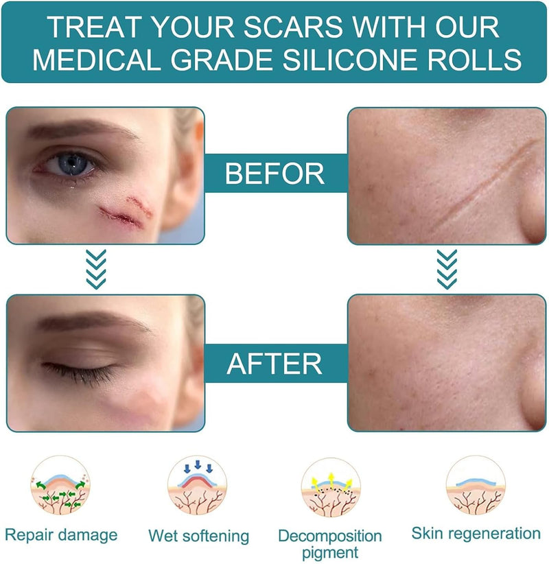 [Australia] - Medical Grade Silicone Scar Sheets, Silicone Scar Tape (1.6”x 120”), Professional Scar Removal Treatment, Reusable Silicone Scar Strip for Keloid, C-Section, Surgery, Burns, Acne Etc 
