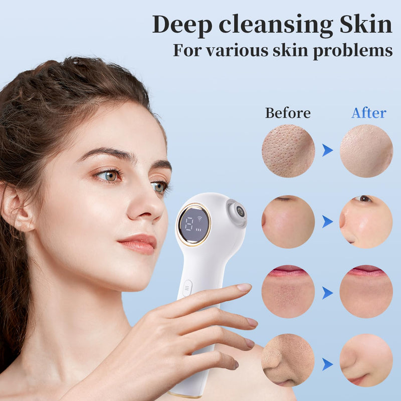 Blackhead Extractor with Camera, Black Head Remover for Face,Pore Extractor for Black Head and Acen, Blackhead Remover Tools with USB Rechargeable, Blackhead Remover Vacuum (White) White