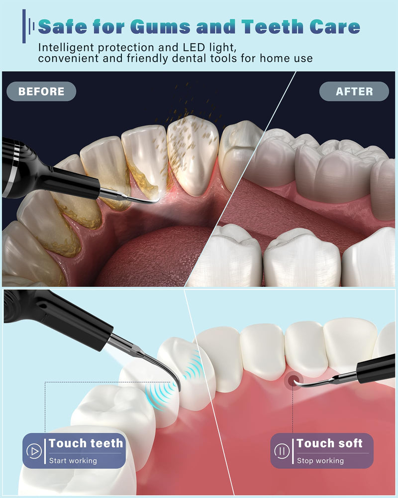 [Australia] - Plaque Remover for Teeth, Dental Cleaning Kit Tartar Remover for Teeth with LED Light & 5 Modes, Rechargeable Dental Cleaner, 4 Replaceable Heads 