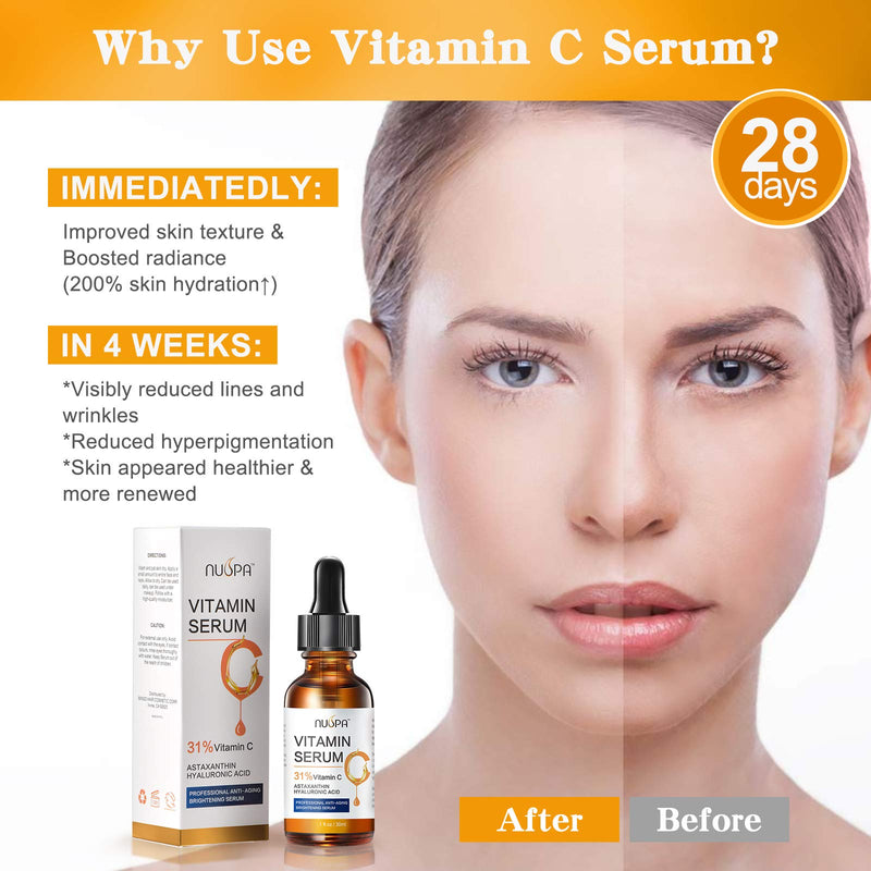 Organic Vitamin C Serum for Face 31% Vitamin C Facial Serum Anti Aging Serum Reduces Age Spots, Face Dark Spots, Sun Damage, Skin Brightening Facial Serums with Hyaluronic Acid and Astaxanthin 1.02 Fl Oz (Pack of 1)