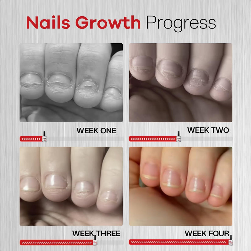 Glamonade 2-in-1 Stop Nail Biting Treatment Kit: Extra Bitter Polish to Deter Biting & Professional Nail File to Smooth Jagged Edges Complete Solution to Remove Biting Triggers for Kids & Adults | Gentle 100/180 Grit Erases Bite-Trigger Edges, 12ml Pla...