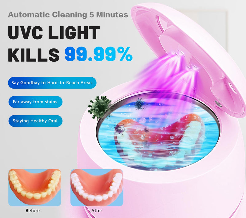 [Australia] - Ultrasonic denture cleaner for dentures, mouth guards, toothbrush heads, jewelry - 45 kHz Ultrasonic Retainer Cleaner (Pink) Pink 