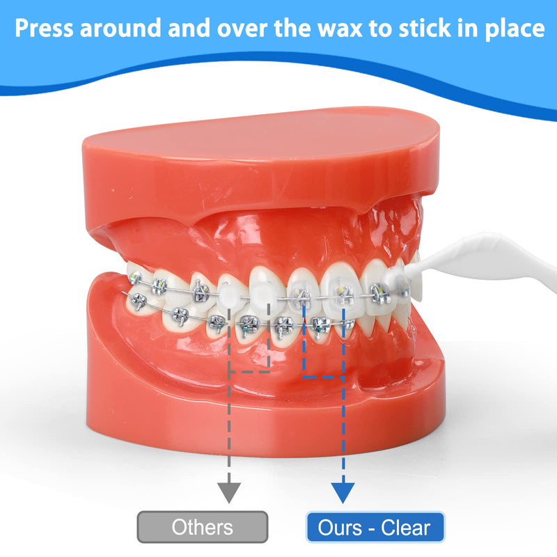 [Australia] - Braces Wax, 10 Pack 50 Precut Wax Strips 350+ Dots, Blue Cases. Includes Storage Box & 2 Applicator Tools, Food-Grade Premium Dental Wax for Braces & Aligners- Stick Better (Mint+Aloe Vera +Vitamin E) 