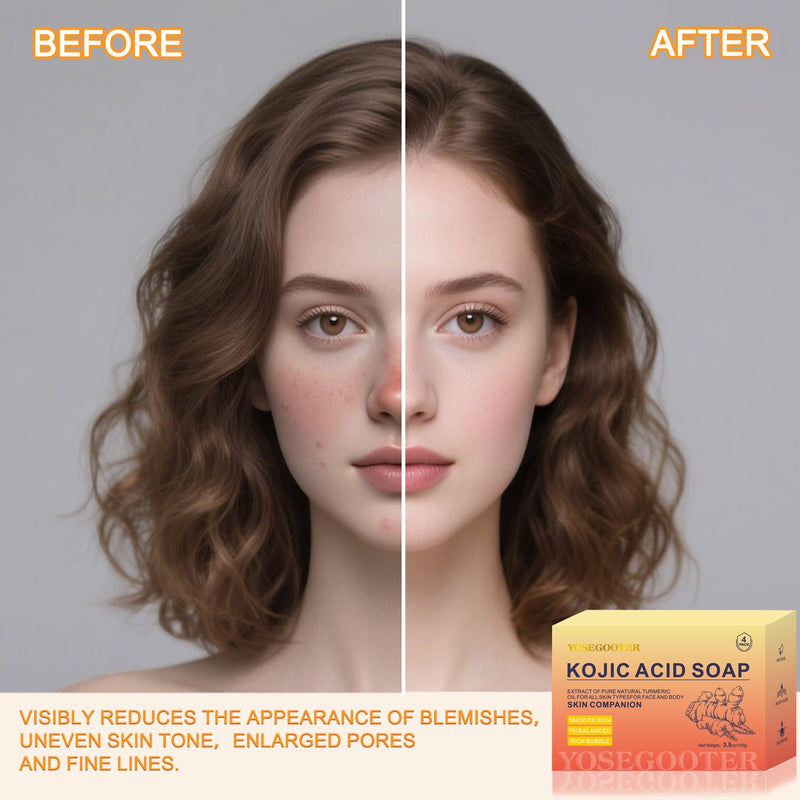 Kojic Acid Soap, Turmeric Soap Bar for Dark Spots remover for face and body with Collagen, Vitamin E, Retinol, Hyaluronic Acid, Shea Butter,Original Japanese Complex, 2 Bars With Face Scrubber 2Pack*100g