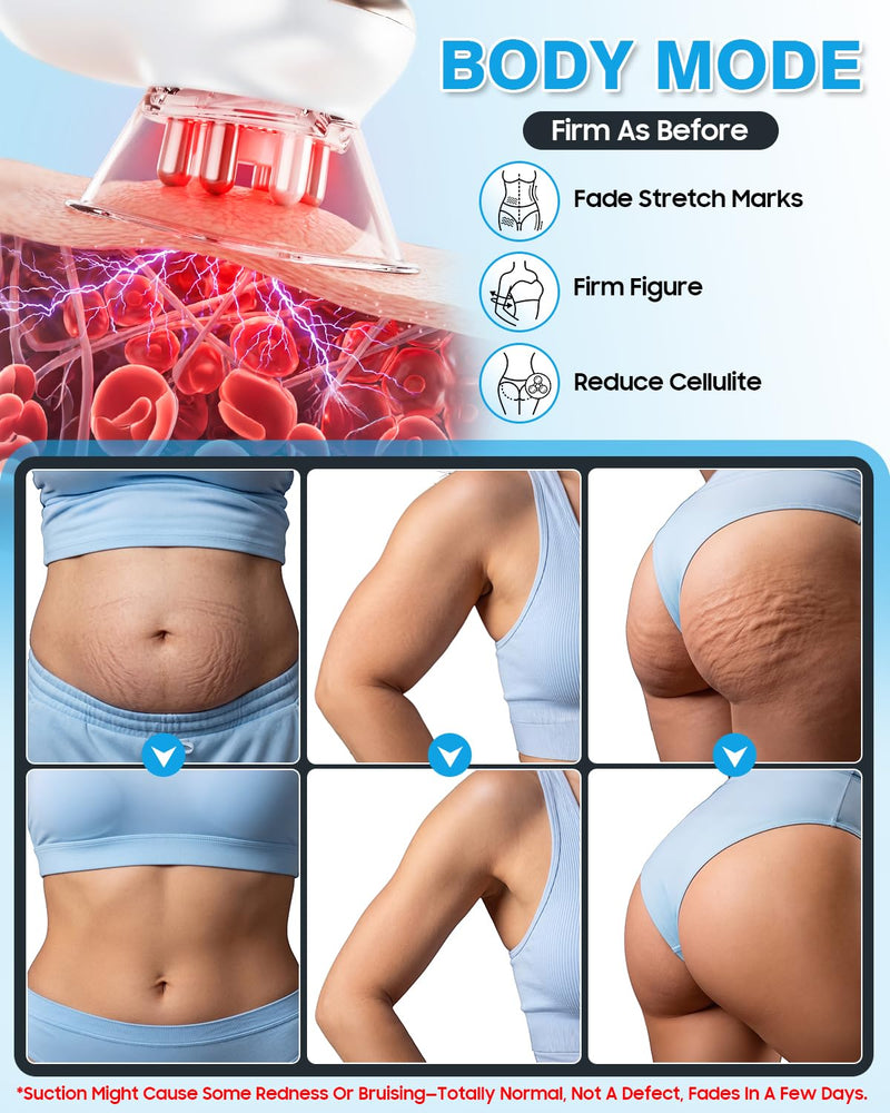 Body Sculpting Machine, 4-in-1 Anti-Cellulite Massager for Body Contouring | Skin Tightening Device for Stomach, Arms, Legs, Thighs, Love Handles, Lymphatic Drainage & Muscle Relaxation White