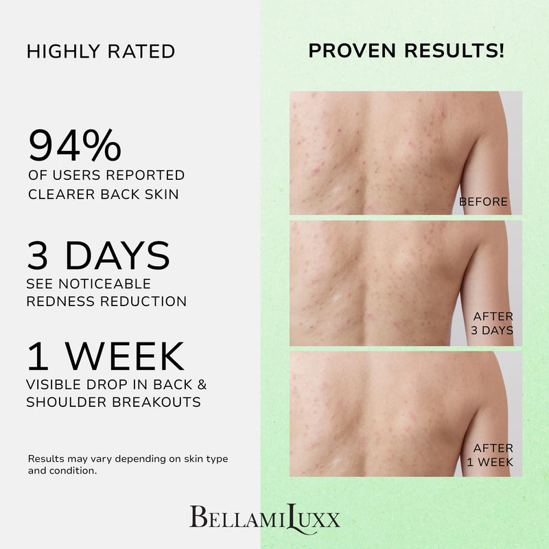 [Australia] - Back and Body Acne Treatment Spray: 2% Salicylic Acid & Tea Tree Oil Bacne Spray for Clear, Soothe & Moisturize - Effective for Men, Women, Teens with Back, Shoulder, Arm, and Chest Acne 4.06 Fl Oz (Pack of 1) 