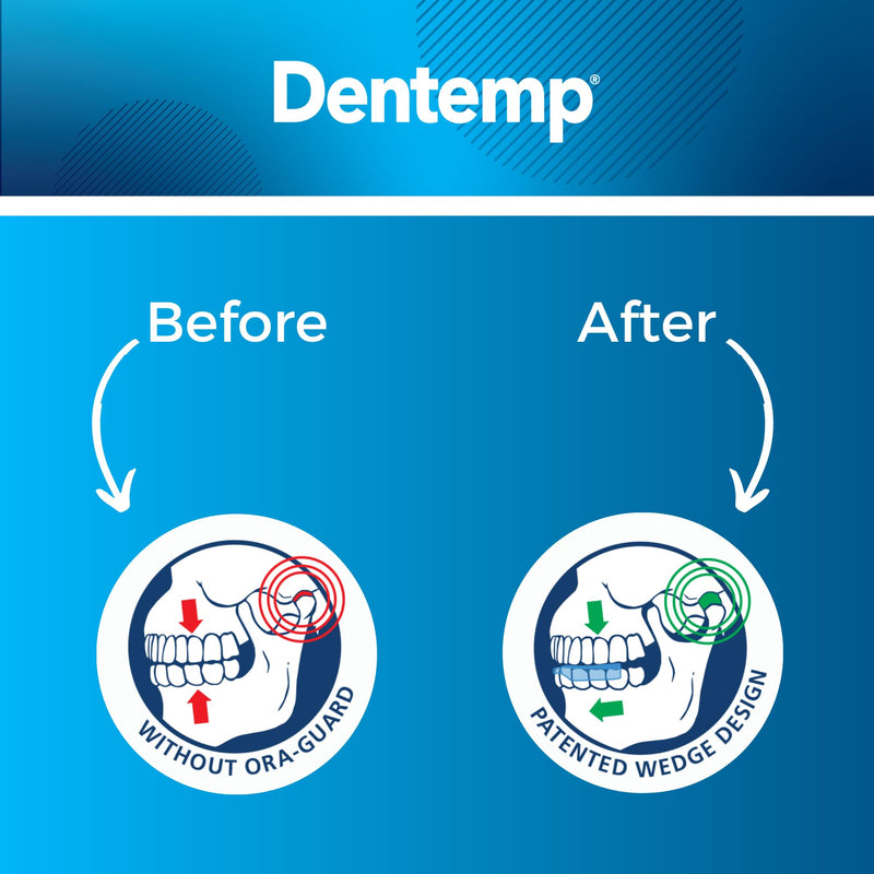 [Australia] - Dentemp Ora-Guard Custom Fit Dental Guard - Bruxism Night Guard for Teeth Grinding - Mouth Guard for Clenching Teeth at Night - Comfortable Mouth Guard for Sleeping - Relieve Soreness in Jaw Muscles… 1 Count (Pack of 1) 