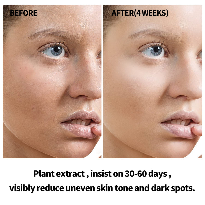 ANAI RUI Squalane Rosehip Oil for face +Vitamin C Turmeric Oil,Hydrate,Firm and Softer Skin