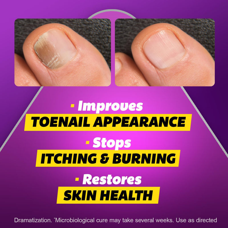 SILKA Max Strength Antifungal Liquid for Toenail Health with Brush Applicator, Results in 1 Week, Nail Fungus Treatment for Damaged Toenails, Athlete's Foot Treatment, Tolnaftate 1% 0.45 Fl Oz 0.45 Fl Oz (Pack of 1)