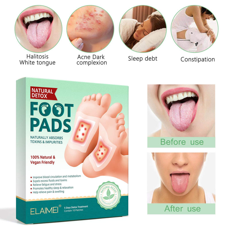 [Australia] - NUEDSFXO Detoxification Plasters Feet, Detox Foot Plasters Detoxification for Deep Sleep & Stress Relief, Deep Cleansing Foot Pads for Removing Body Toxins, Promotes Blood Circulation (10 Pcs) 10 Pcs 