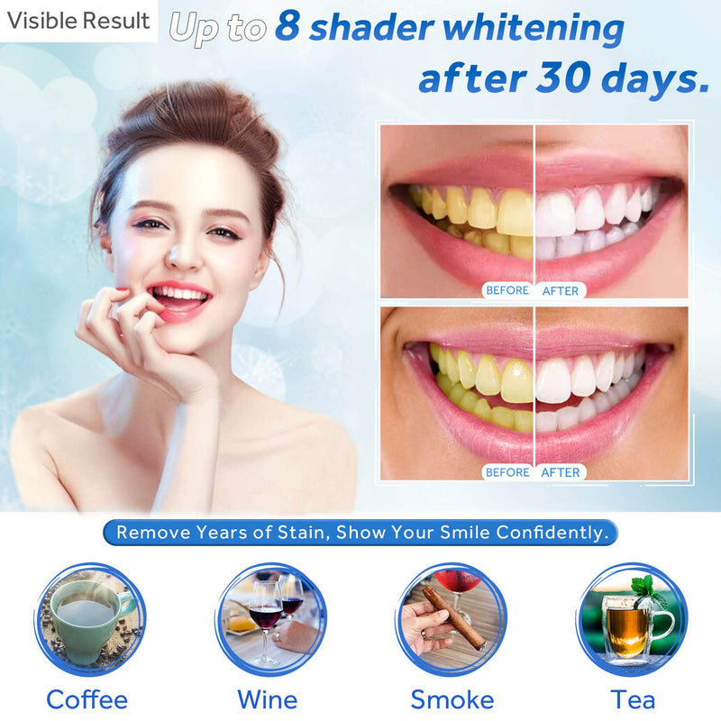 EZGO 10 Pack Teeth Whitening Gel Refills 22% Bleaching Gel, No Sensitive Teeth Whitener, Great for Sensitive Tooth Whitening, Carbamide Peroxide Teeth Whitening Gel, Mint Flavor (10X 5ML) 10*5ml