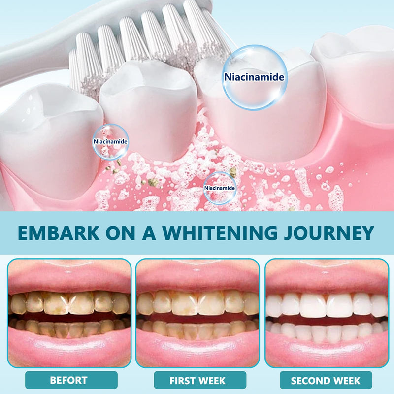 [Australia] - Niacinamide Whitening Toothpaste, Niacinamide Toothpaste, Intense Teeth whitening, Gently Repairs Sensitive Teeth, Protect Tooth Enamel, Fresh Breath, Fluoride-Free(3.5 Ounce (Pack of 1)) 