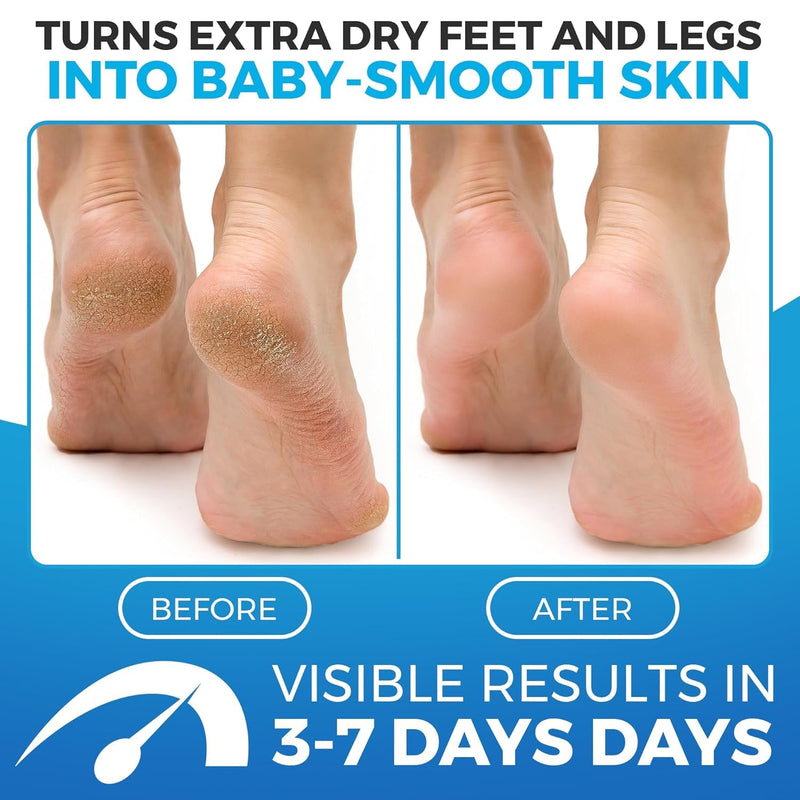 [Australia] - Imperial Feet Foot Balm Green - 150ml Non-Sticky Cream for Dry Feet & Cracked Skin - Aloe Vera Moisturizer for Diabetics - Soothing Hydration & Dryness Skin Repair for Hands, Feet, Legs & Overall Care 