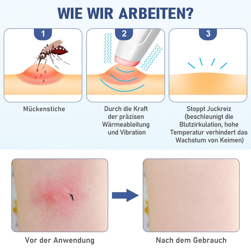 [Australia] - ICARE insect bite healer, mosquito bite heat pen, electric bite healer for quick relief, chemical-free insect bite pen, electric bite healer, 4 levels of heat regulation, white 
