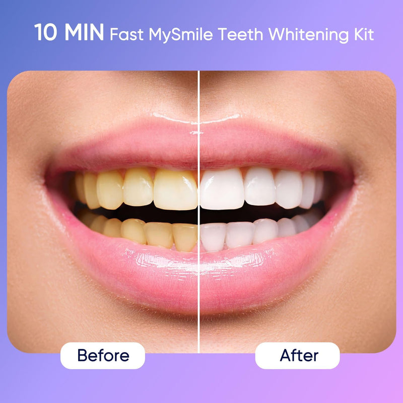 MySmile Teeth Whitening Kit for Sensitive Teeth, 30+ Treatments Whitener | 4*3ml 35% Carbamide Peroxide Whitening Gel+4ml Remineralization Pen & 28LED Whitening Tray Light, Remove Years of Stains 16 Fl Oz (Pack of 1)