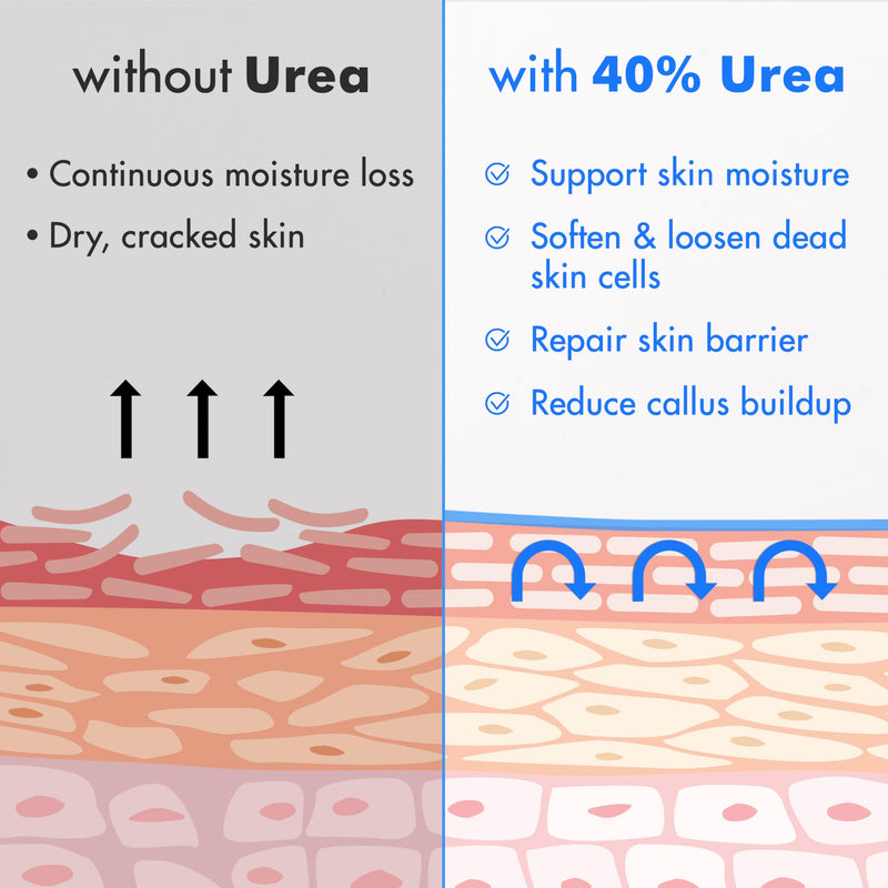 Ebanel Urea Cream 40% plus Salicylic Acid 2% for Dry Cracked Feet Skin | Deeply Moisturizes & Softens Dry Cracked Heels, Feet, Knees, Elbows, Hands, Rough Dead Skin Callus Remover Toenail Softener 4.6 Ounce (Pack of 1)