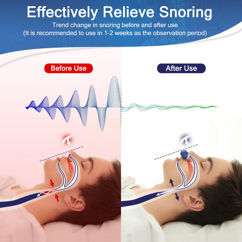 [Australia] - Mini Anti Snoring Devices,Stop Snoring Reduction,Electric Anti Snore Device,Adjustable Airflow Snoring Solution Aids for Men & Women,Blue Blue 
