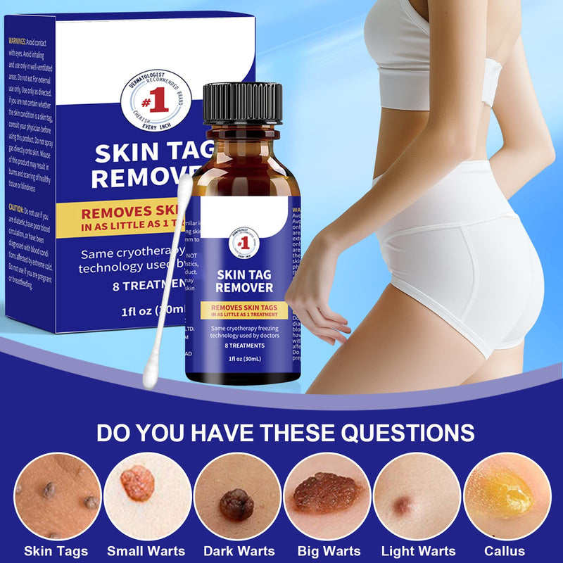 [Australia] - 30 ml skin tag remover, stalk warts removal quickly, skin tag remover kit, easy and convenient for most body parts, leaves the skin smooth 