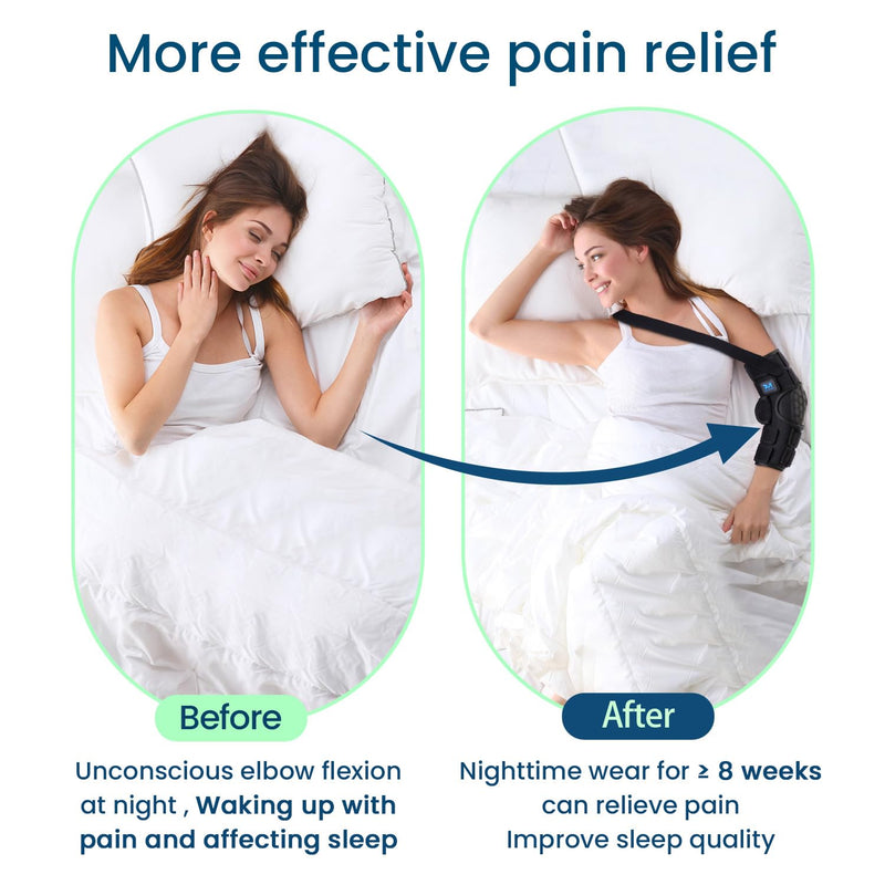 [Australia] - Cubital Tunnel Syndrome Elbow Brace Splint For Ulnar Nerve Entrapment Black L 