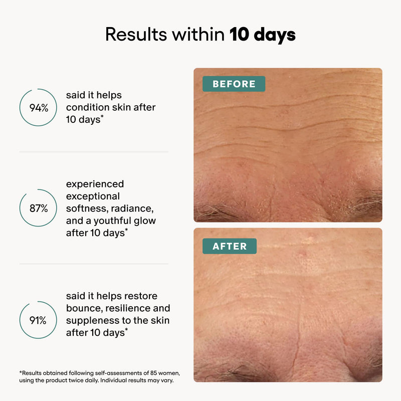 Algenist GENIUS Mini Liquid Collagen Serum - Firming & Hydrating Vegan Face Serum with Alguronic Acid + Vitamin E - Helps Visibly Minimize Fine Lines + Wrinkles & Improve Elasticity (0.21 oz) 0.21 Fl Oz (Pack of 1)