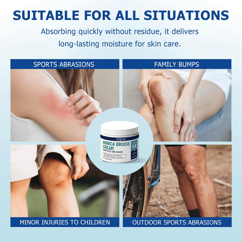 Arnica Bruise Cream Extra Strength,Fast-Acting for Bruising & Swelling on Thin Skin - Advanced Formula with Arnica Montana Vitamin K C & E - Soothing Hydrating for Face and Body 1pcs