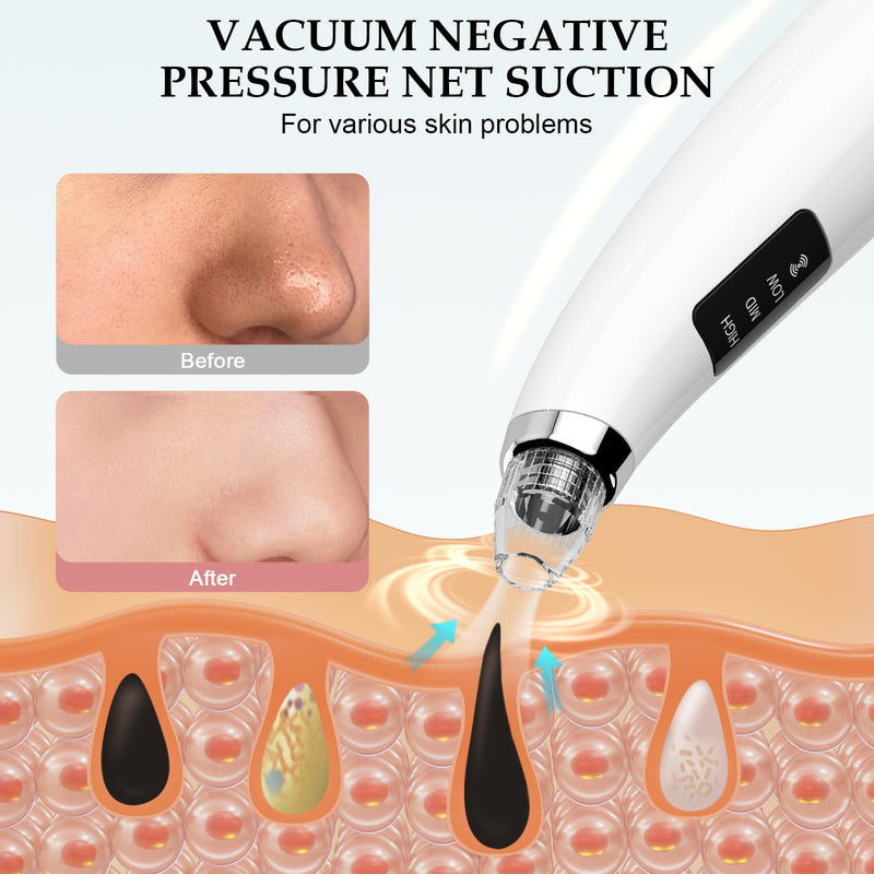 Blackhead Vacuum Removers - Pore Vacuum for Face with 5 Attachments & 3 Suction Levels - USB Rechargeable Blackhead Remover Tools for Women and Men (White)