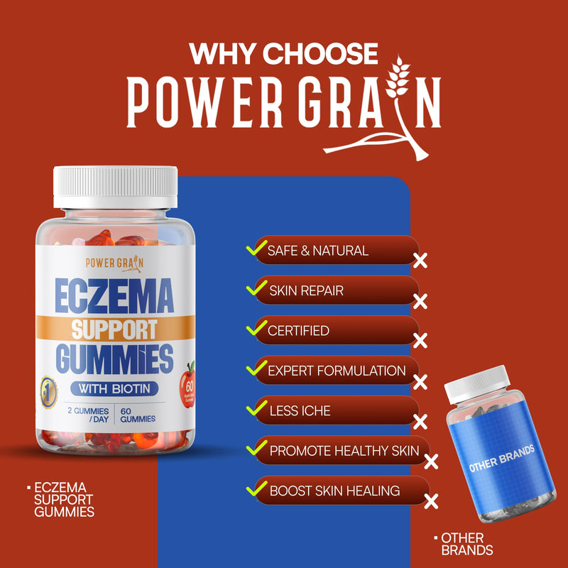 Ezcema Support Gummies – USA-Made - 30+ Vitamins with BIOTIN for Eczema, Psoriasis, Rosacea, & Dermatitis Relief – Soothes Itching, Redness Relief