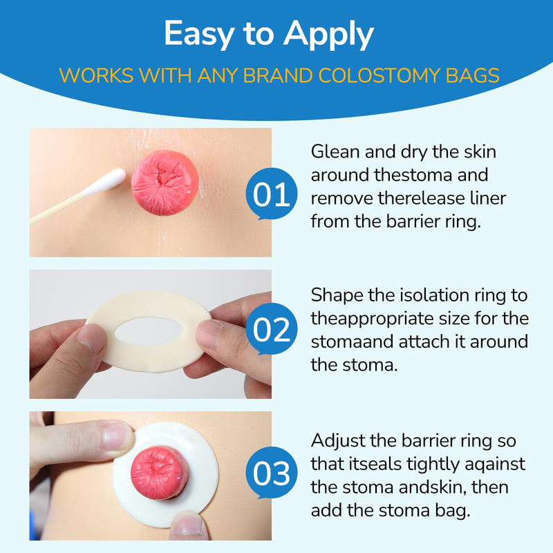 [Australia] - 10PCS Ostomy Barrier Rings, Ostomy Supplies, 2mm Thickness Moldable Ostomy Rings Medical Grade Hydrocolloid Adhesive Barrier Rings Better Seal for Ostomy Bags (Box of 10) 2mm Ostomy Barrier Rings 