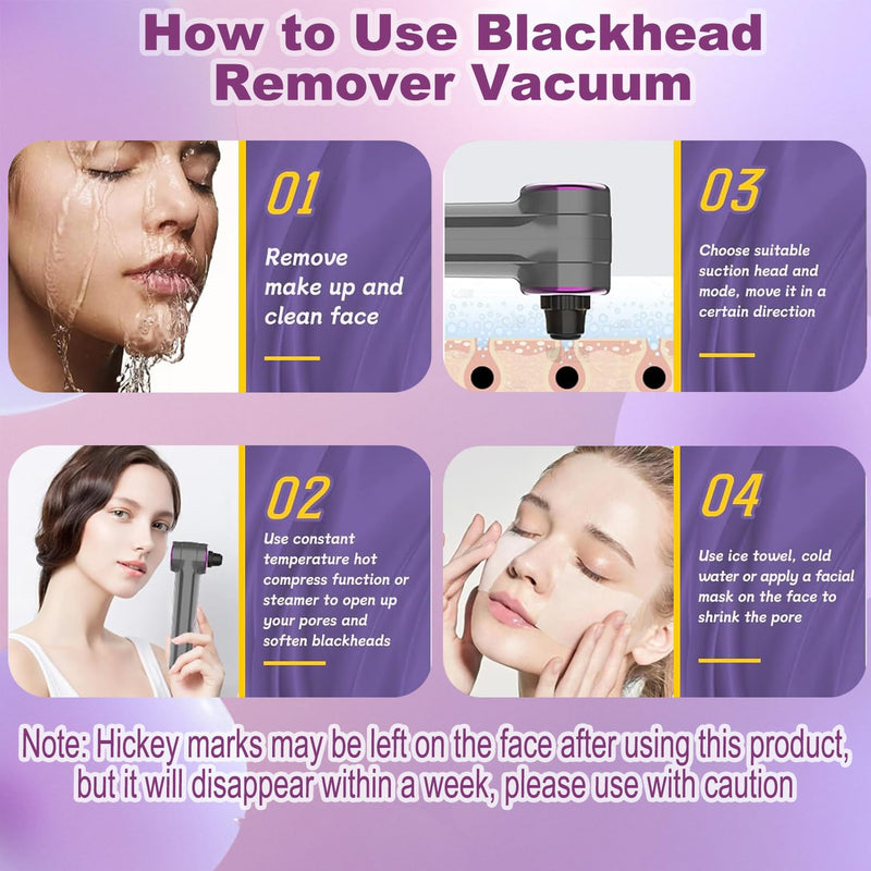 Blackhead Remover Pore Vacuum with Hot Compress, Upgraded Facial Pore Cleaner, Pore Extractor Acne White Heads Removal Tool- 9 Suction Power, 5 Probes Blackhead Vacuum Kit for Women & Men 1 Count (Pack of 1)