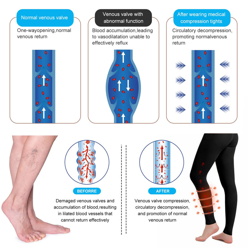 [Australia] - Medical Compression Pantyhose for Women & Men, 20-30mmHg Graduated Support Tights, Opaque Footless High Waist M Black 