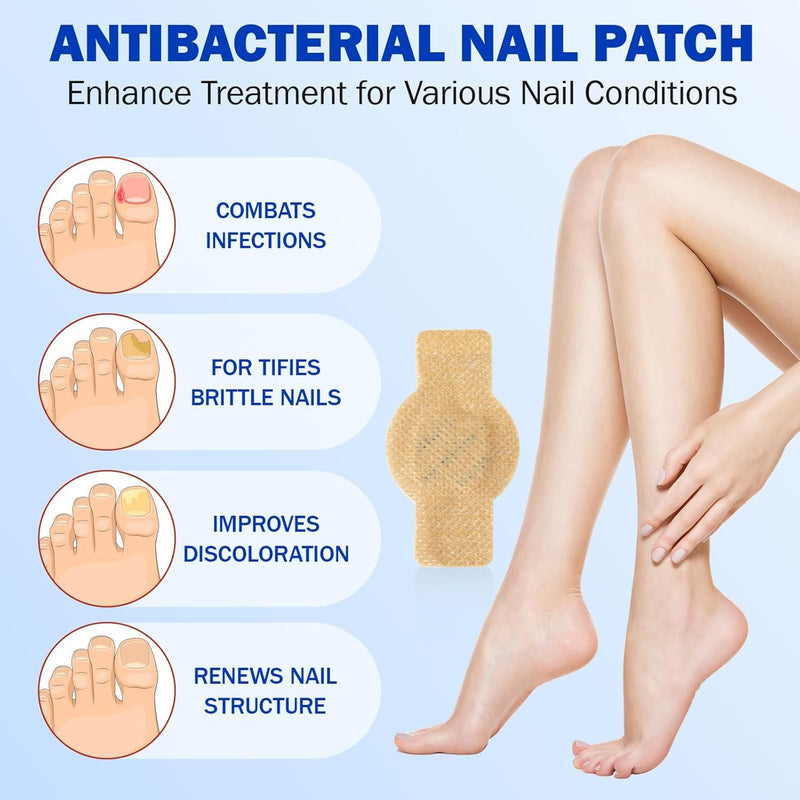 Nail Patches, Nail Patches for Toenails, Nail Treatment Patches Extra Strength, Extra Strong 8-Hour Repair Nail Plasters, Overnight Toe Nail Care Repair for Damaged Nails 4.04 Ounce (Pack of 1)