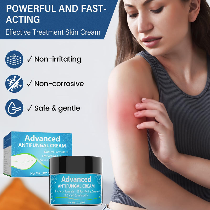[Australia] - Skin fungus cream, athlete's foot cream with tea tree oil and herbal extracts, Expertcare fungicide for the treatment of athlete's foot and psoriasis - against itching, soothes, inflamed & dry skin 30 ml 