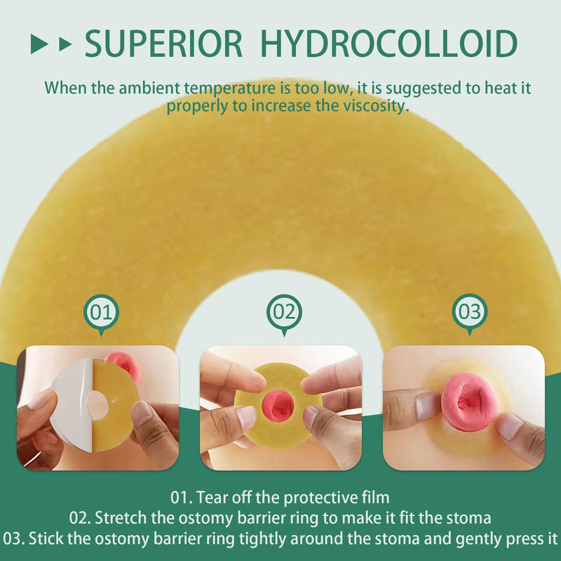 [Australia] - 30Pcs Ostomy Barrier Rings, 2mm Thickness Hydrocolloid Tape Cohesive Seals, Elastic Moldable Skin Extender, Ostomy Supplies for Colostomy, Ileostomy & Urostomy Bags 