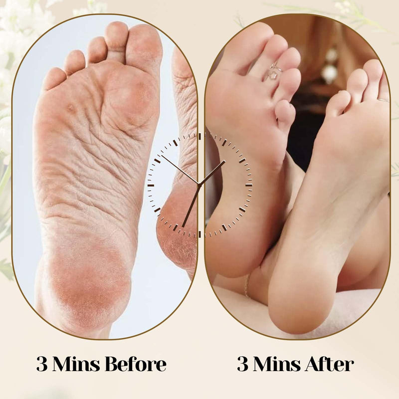 [Australia] - Pumice Stone Foot Care Callus Remover Foot Scrubber Removes Cracked Heels Light Stone Pedicure Foot Rasp Dead Skin Hard Skin File Brush for Feet Hands Body Wet and Dry Shower 