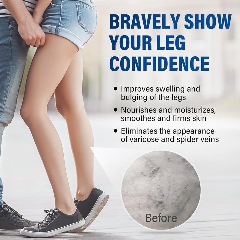 [Australia] - Grgowe Varicose Veins Cream, Varicose Veins Cream, Cream for Spider Veins, Active Veins, Anti-Varicose Veins Cream, Cream for Relieving and Preventing Varicose Veins, Improve Blood Circulation for Legs 