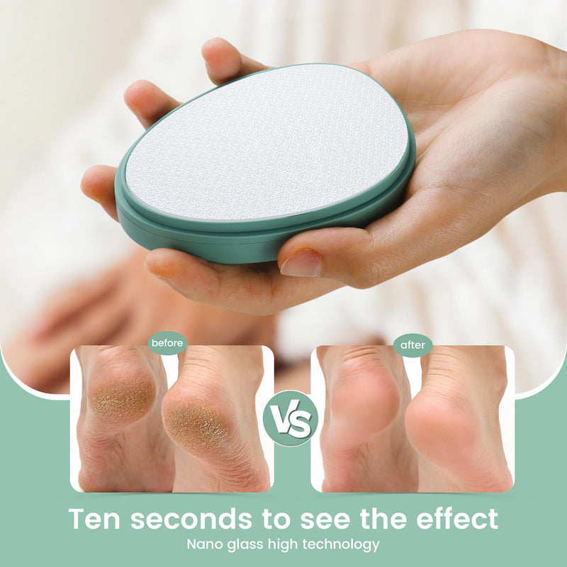 [Australia] - BEZOX 2-in-1 Nano Glass Callus Remover - Highly effective callus file for velvety-soft feet - Professional foot care safely & quickly For removing calluses on wet and dry feet Green 
