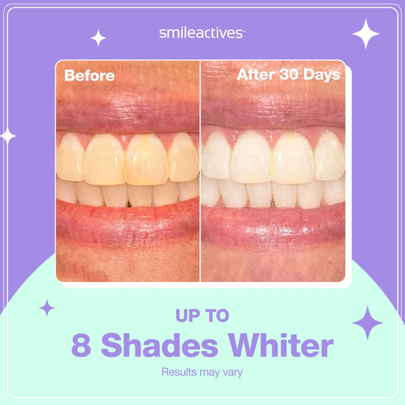 [Australia] - Smileactives ProLite Professional Teeth Whitening Kit, Dental Quality LED Light Teeth Whitener for White Teeth & Smile, 16 Minute Built-in Timer, Teeth Whitening Products, Helps Remove Tooth Stains 