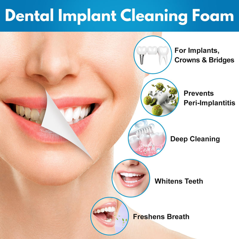 Dental Implant Cleaner, Cleans & Whitens Implants, Crowns, Bridges & Veneers, Freshens Breath & Supports Oral Health, Dental Bridge Cleaner Foam Bring Your Smile Back, 60ml