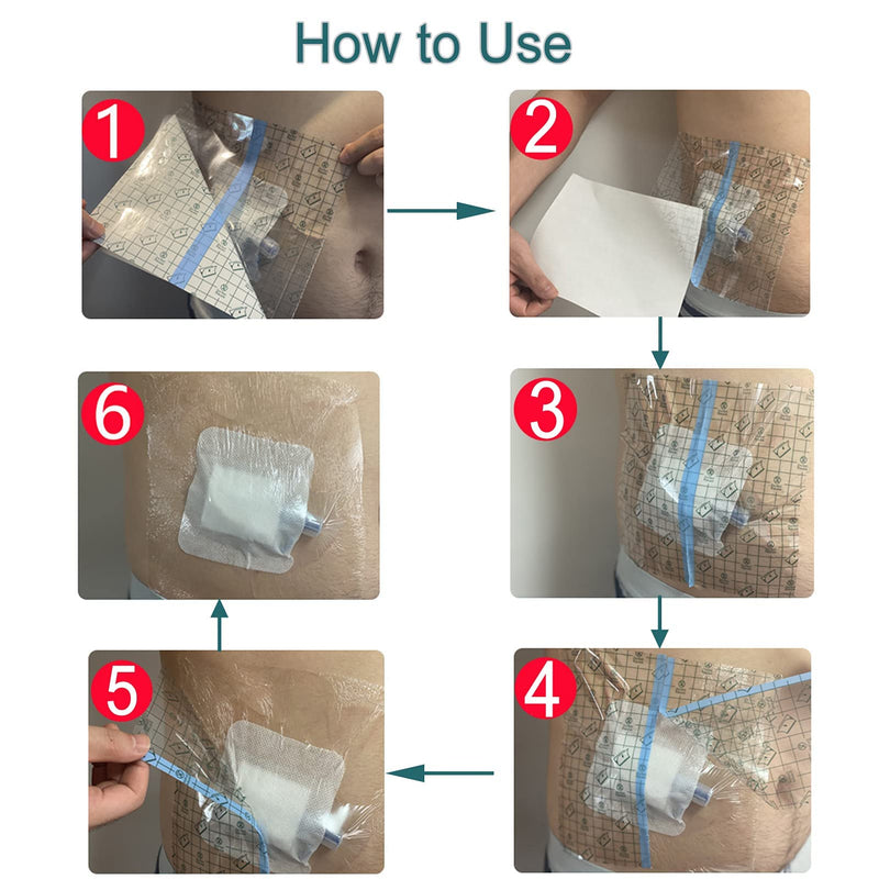 [Australia] - Waterproof Ostomy Bag Shower Cover with Non Sticky Pad Colostomy Ilostomy Urlostomy Pouch Shower Guard Shield 9x9, 25pcs Ostoma Cover(9"x9", Pack of 25) 