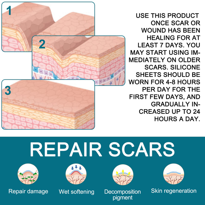 [Australia] - Silicone Scar Plaster, Professional for C-Section Scars, Surgery, Burns, Keloid, Acne and More, Drug Free, Silicone Scar Roller(4CMx300CM) 4CMx300CM 