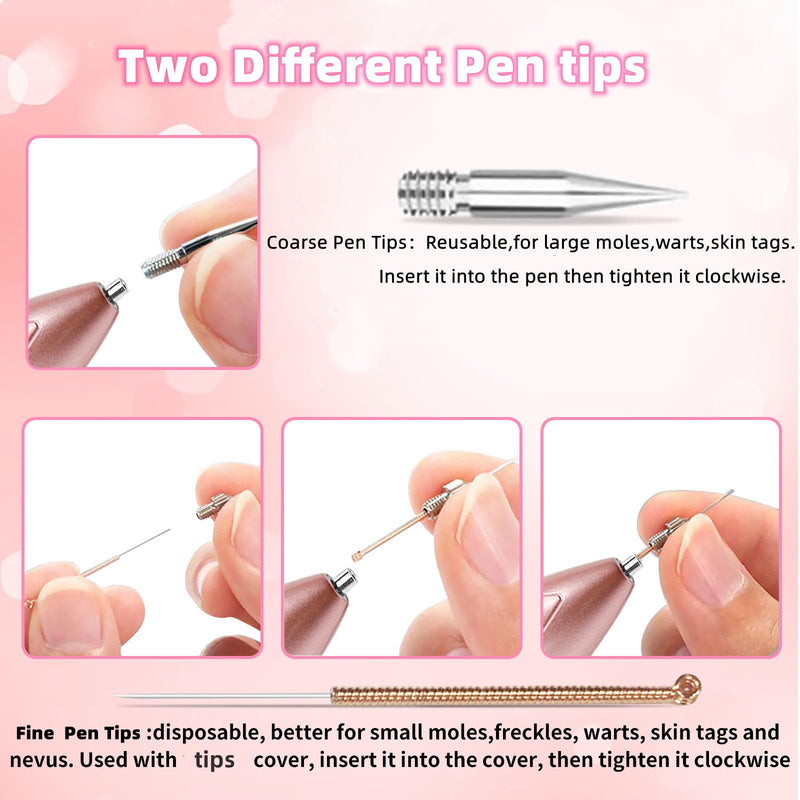 [Australia] - CHRERNA Birthmark Removal Pen, Wart Removal Pen with 9 Strength Safe and LCD Screen Plasma Pen Device for Hand and Body (Nevus, Birthmarks, Pigment Spots, Age Spots) Pink 