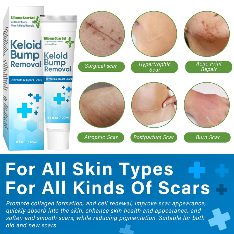 [Australia] - Scar ointment, premium scar gel, effective for keloid scar treatment, reduces tissue tension and itching 