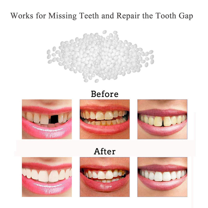 [Australia] - Tooth Repair Kit-Thermal Beads for Filling Fix The Missing and Broken Tooth or Adhesive The Denture Fake Teeth 